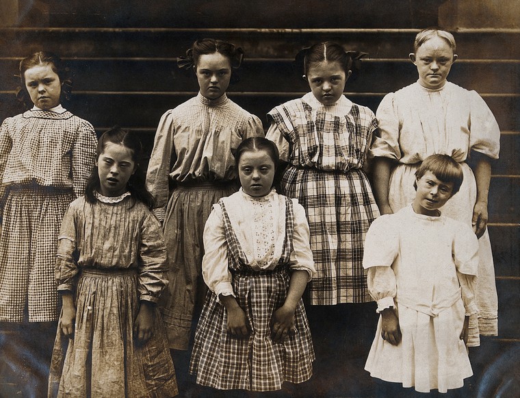Sepia photograph of seven girls with Down syndrome standing on the steps of an institution. They are wearing dresses and not smiling.